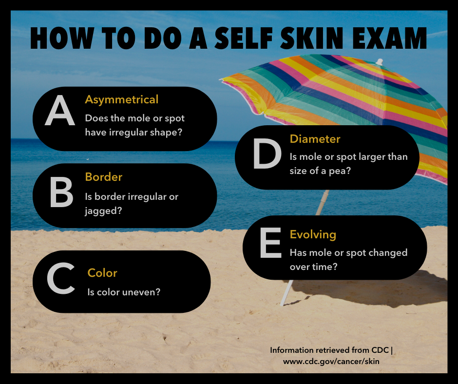 Chart on how to conduct self skin exam: A for asymmetry, B for border, C for color, D for diameter and E for Evolving. Background image is of beach umbrella. 